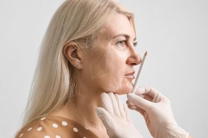 a woman getting plastic surgery done