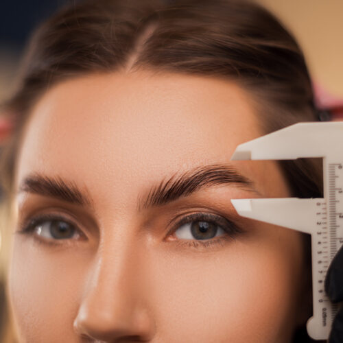 endoscopic brow lift