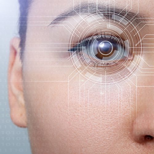 intralase laser eye surgery