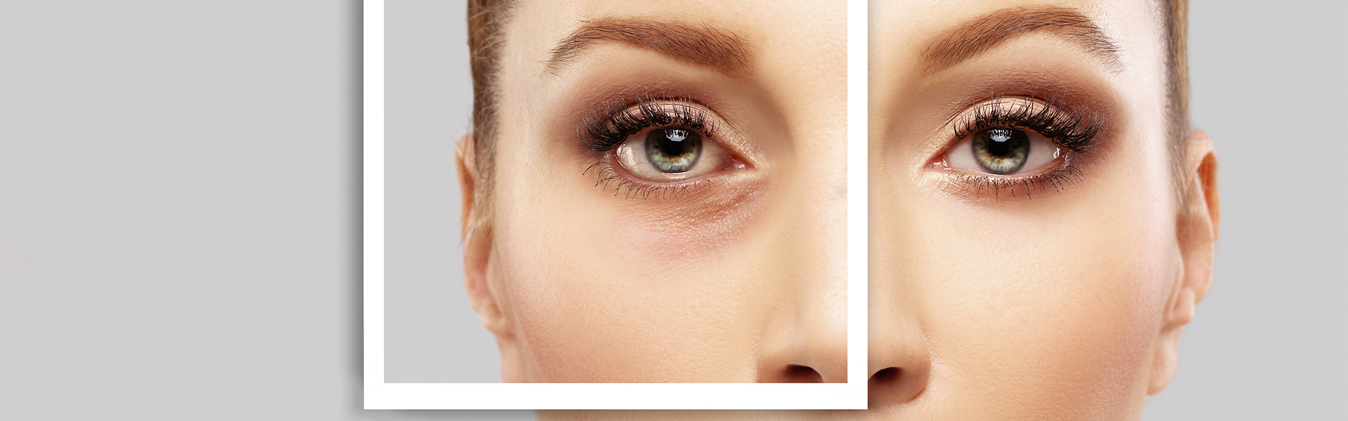 jalupro young eye treatment