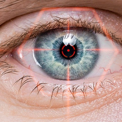 multifocal lens replacement