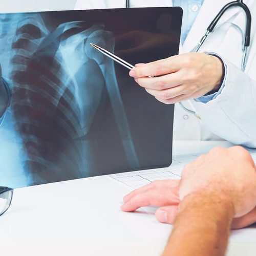 shoulder rotator cuff repair