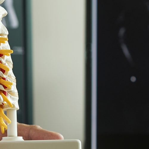 spinal fusion surgery