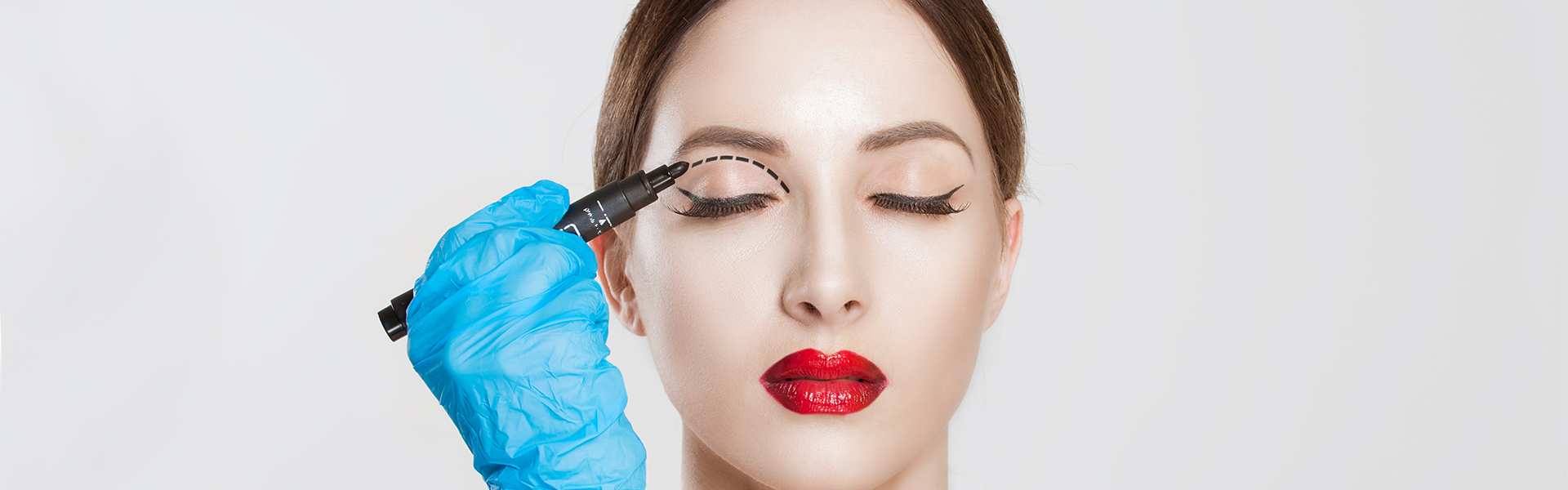 upper eyelid surgery