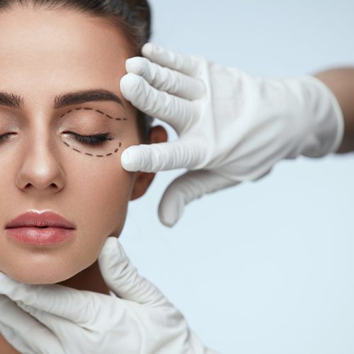 upper and lower eyelids removal