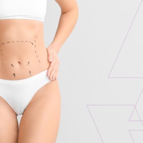 High Definition Vaser Assisted Liposuction