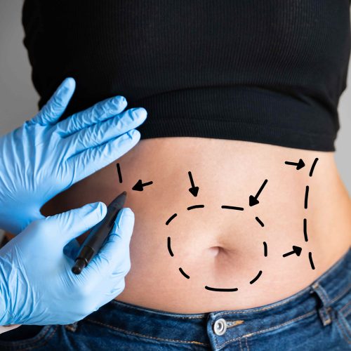 Enhancement Mommy Makeover Package