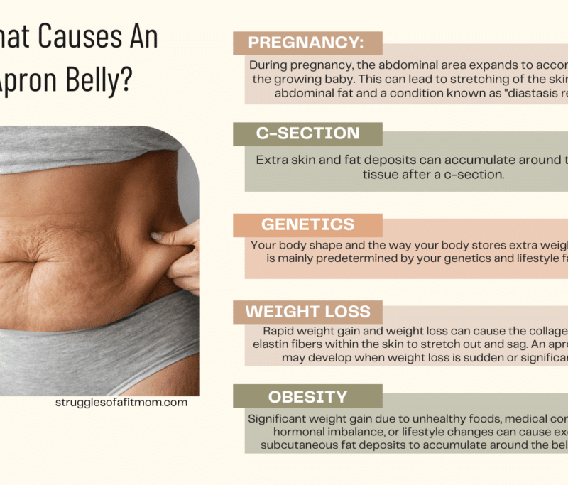 Apron-Belly-causes