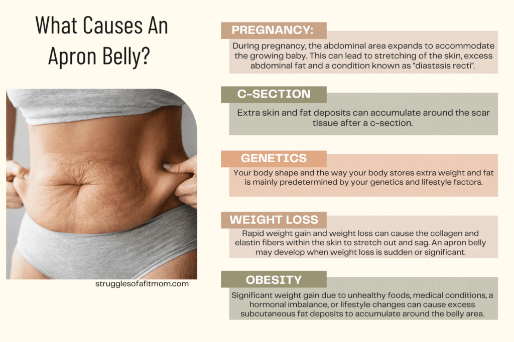 Apron Belly Causes: Understanding the Factors