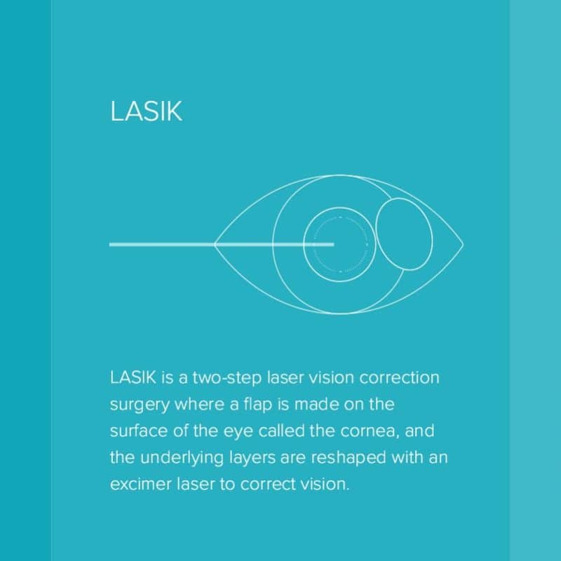 evo-icl-lasik