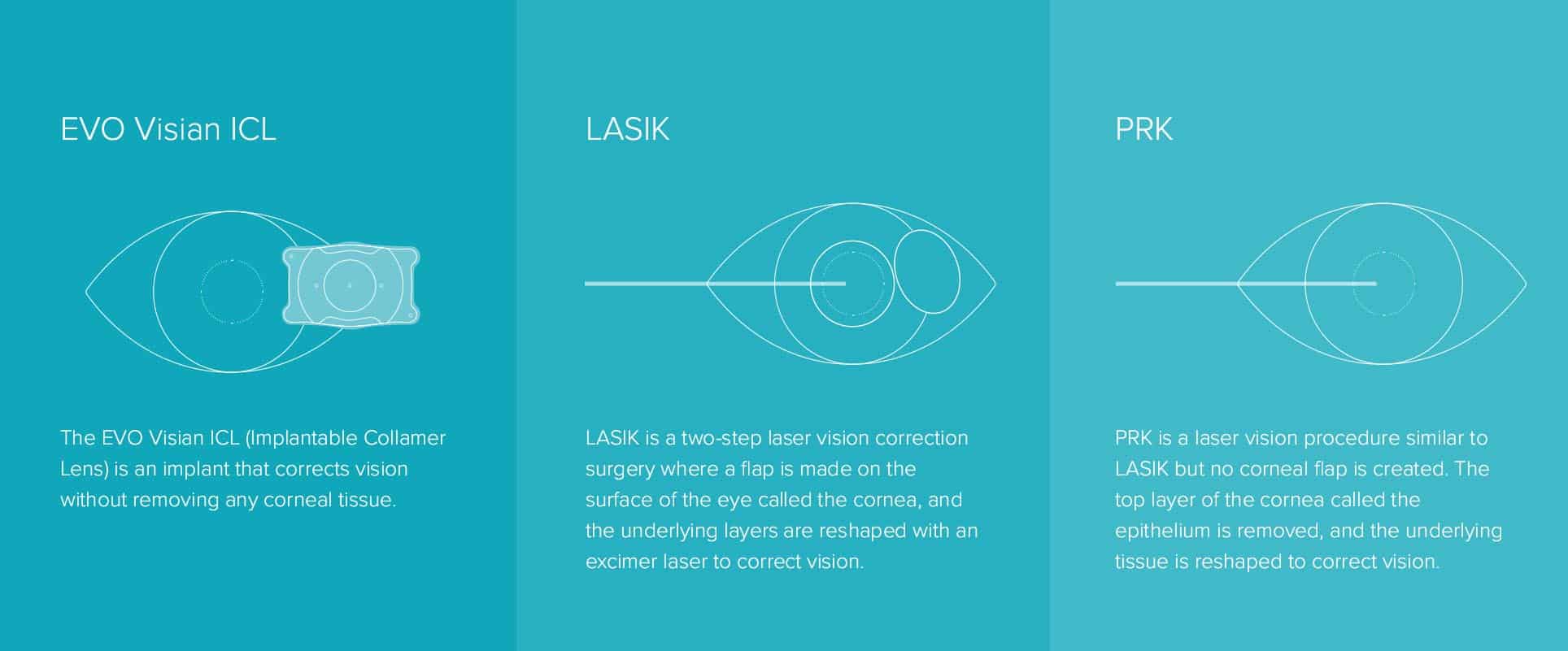 EVO ICL vs LASIK: Which Vision Correction Is Best?