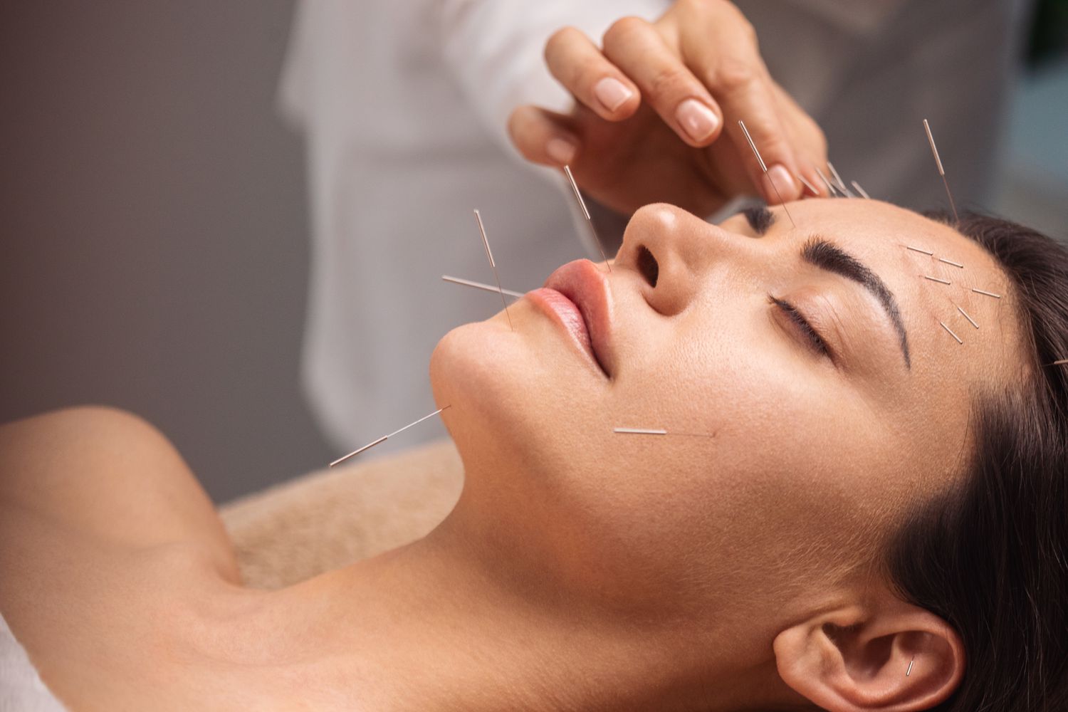 Facial Acupuncture: Natural Beauty Enhancement