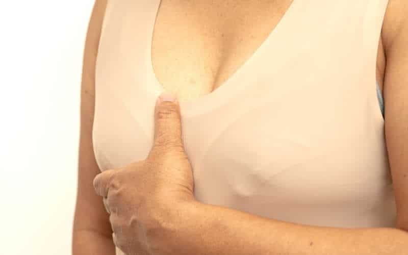 Breast-Reconstruction-options1