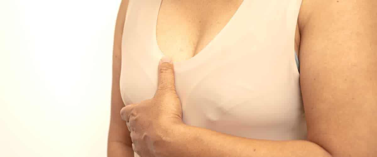 DIEP Flap Reconstruction: Breast Restoration Options