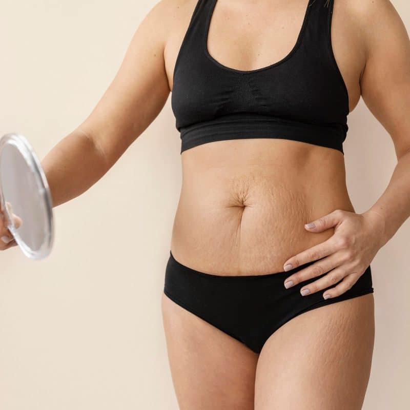 affordable tummy tuck price turkey cost guide 2024