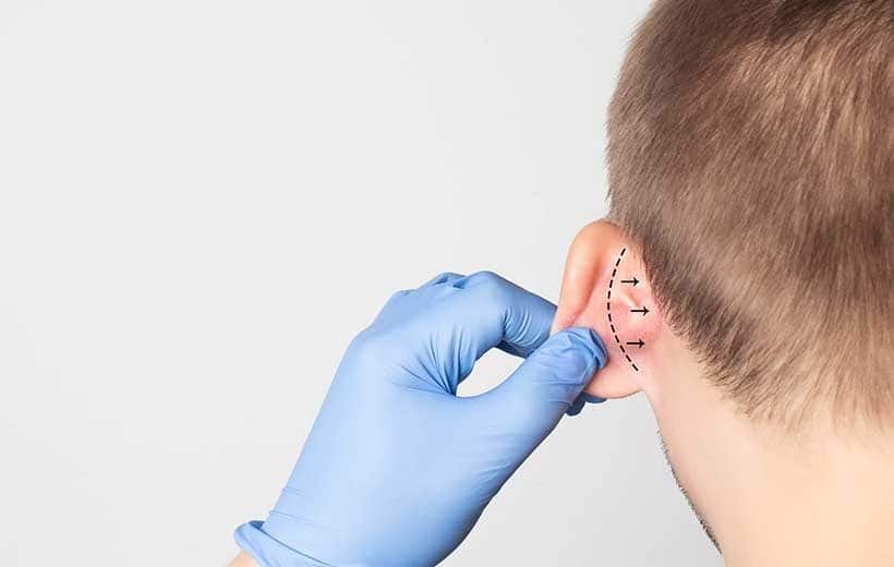 Exploring Common Ear Surgery Types and Procedures