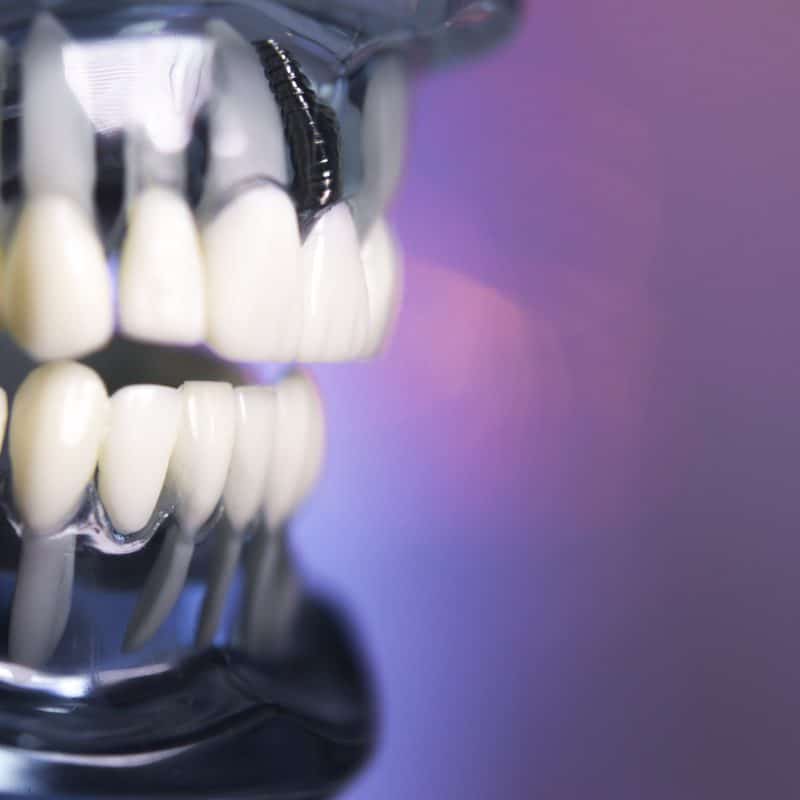 complete-dental-implants-turke