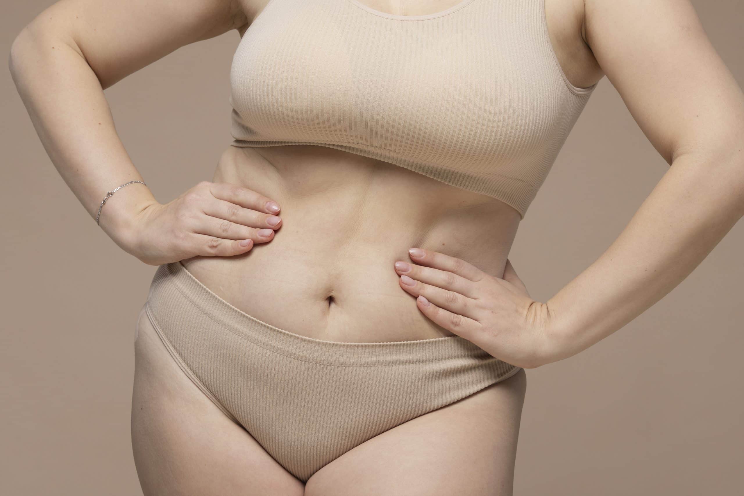 Panniculectomy: Post-Weight Loss Skin Removal Surgery