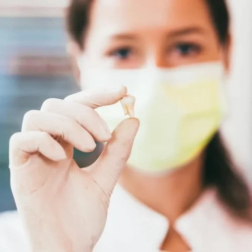 Tooth Extraction