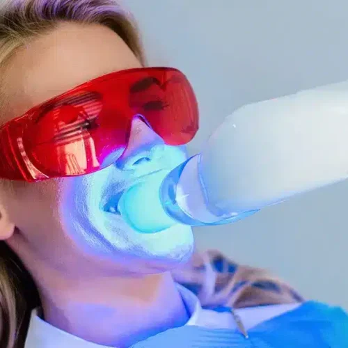 Teeth Whitening In Turkey