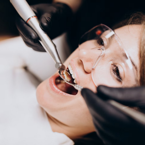 Oral Prophylaxis
