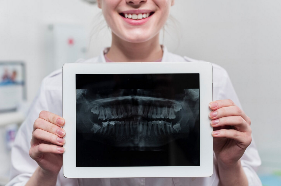 Dental X-Ray