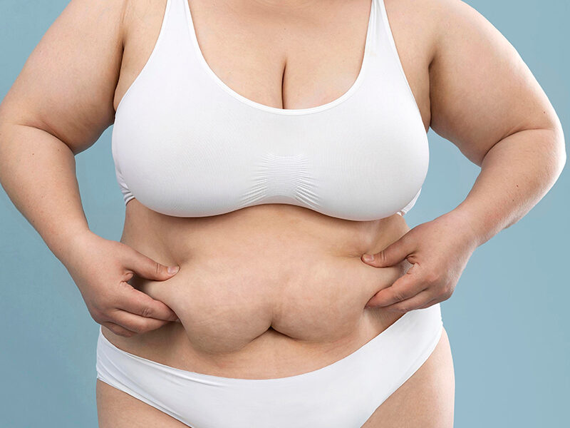 gastric bypass surgery