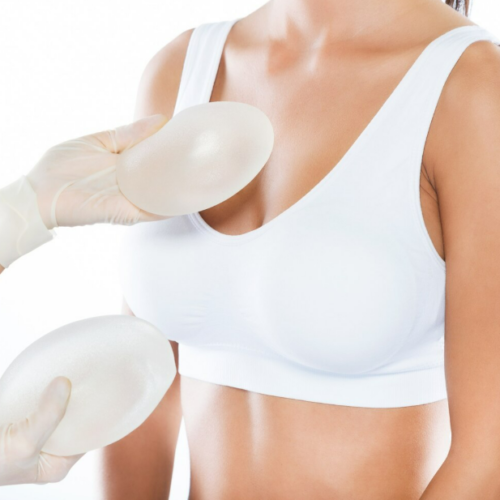 breast augmentation