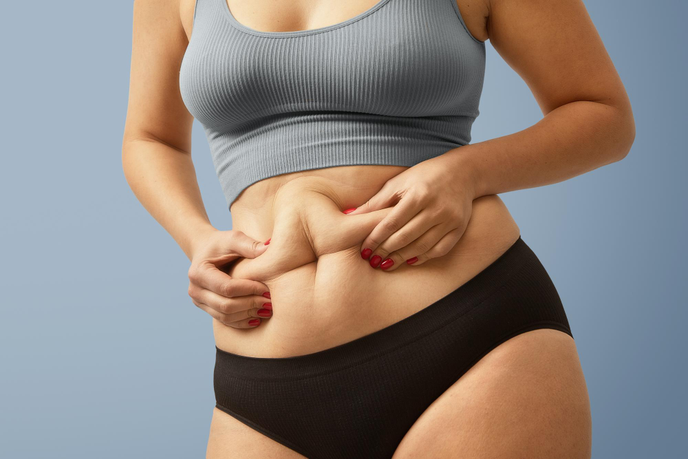 Reverse Tummy Tuck