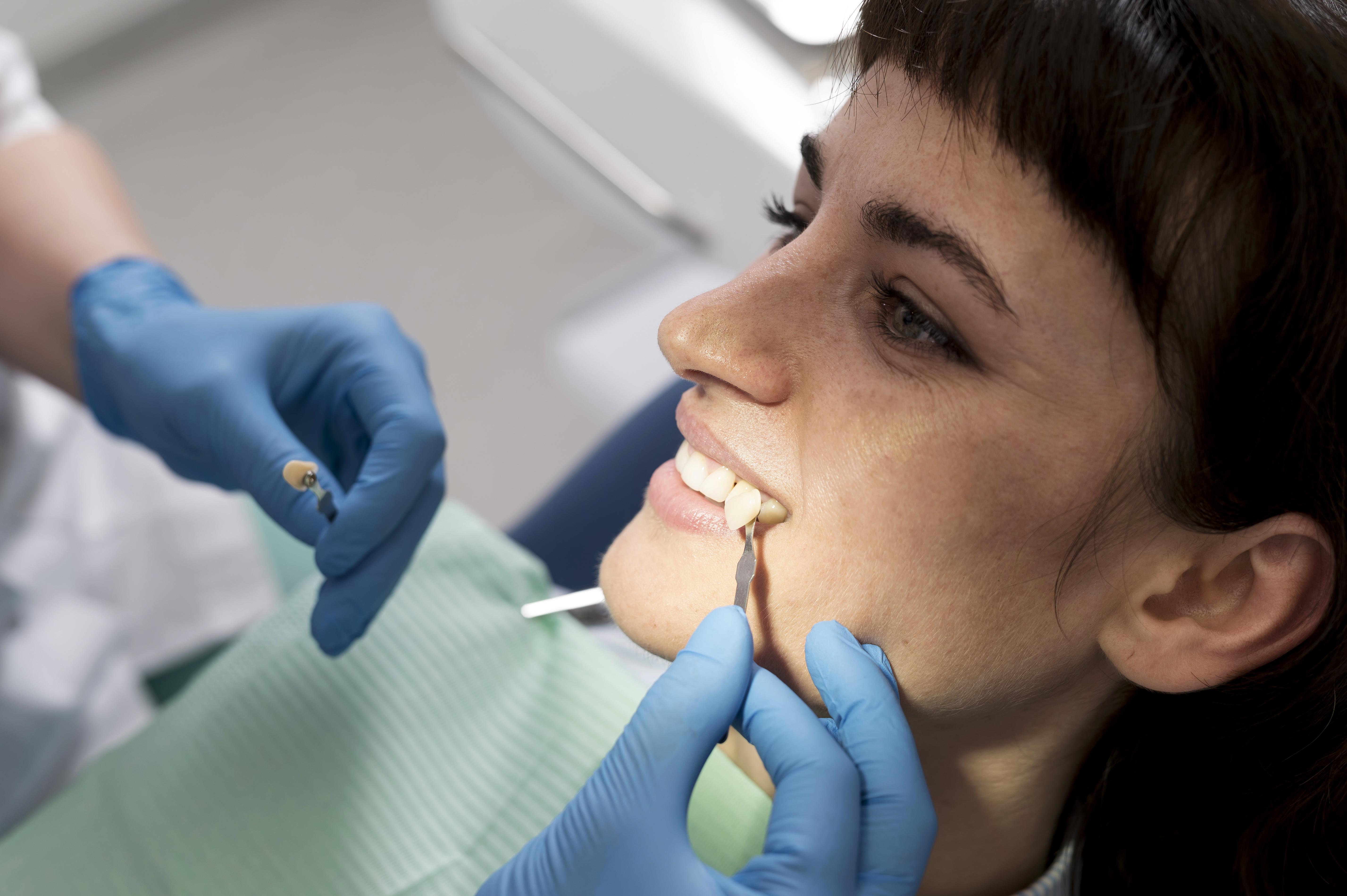 Zirconium Crowns