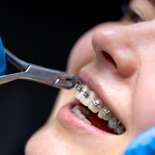 Orthodontics