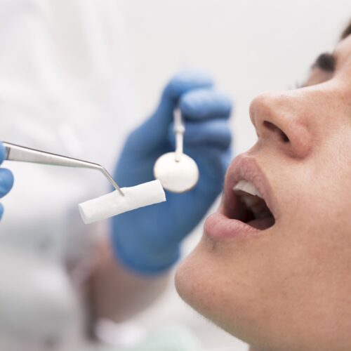 Oral Cyst Removal